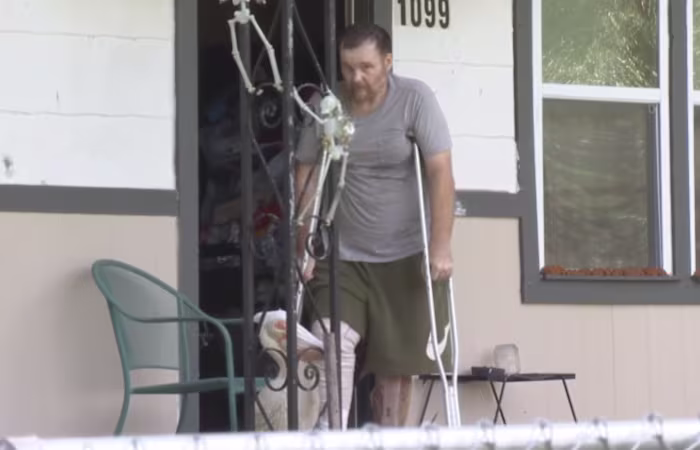 Featured image for Uninsured Man with Flesh-Eating Bacteria Discharged, Hospital Responds