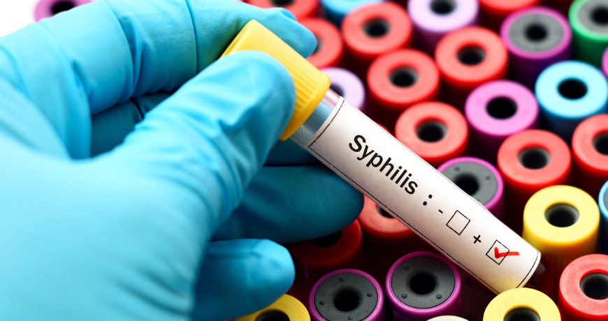 Featured image for "Rising Syphilis Cases in US Spark Concern Amid Shortage of Life-Saving Drug"