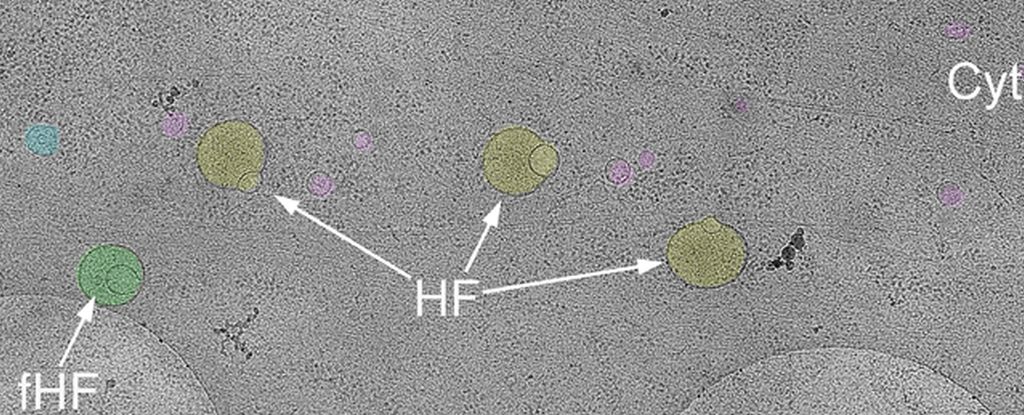 Featured image for Scientists Discover New Organelle Hidden Inside Human Cells