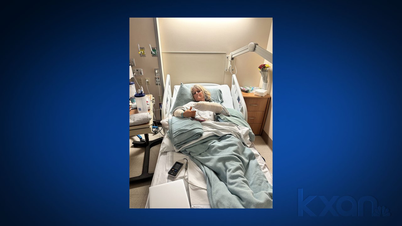 "Fredericksburg Woman's Miraculous Recovery: Peeling Arm from Vehicle Hood"
