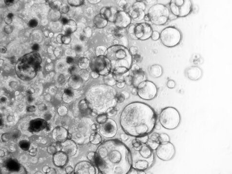 Featured image for Unveiling the Predictable Evolution of Human Cancers