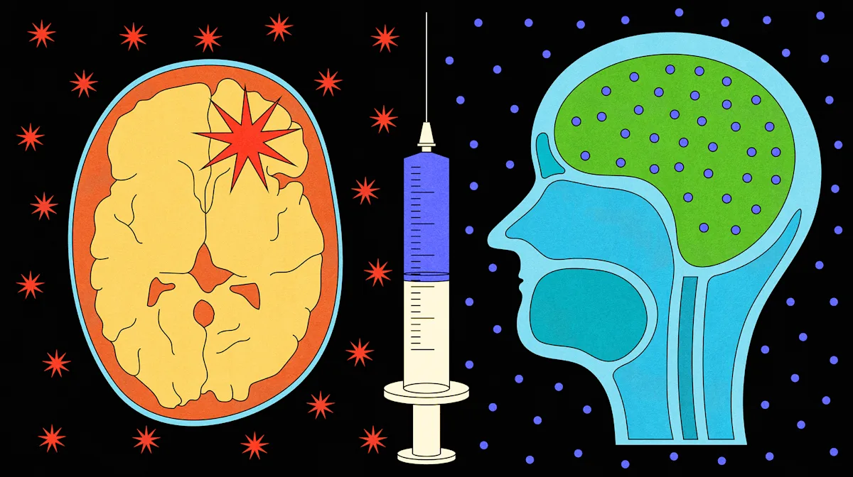 New vaccine delays aggressive brain tumor recurrence.