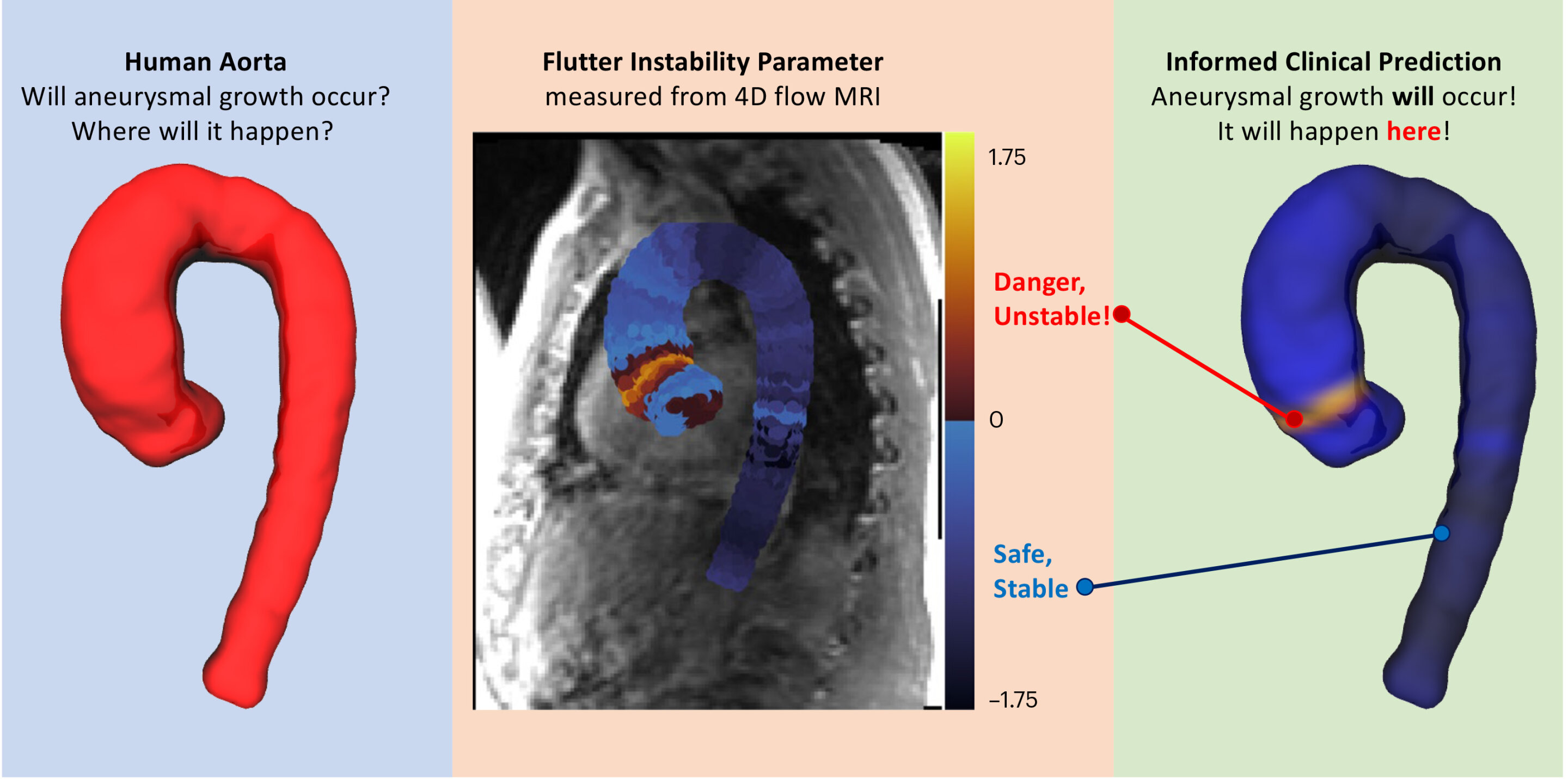 Featured image for Predicting Aortic Aneurysm with 98% Accuracy through Unstable 'Fluttering'