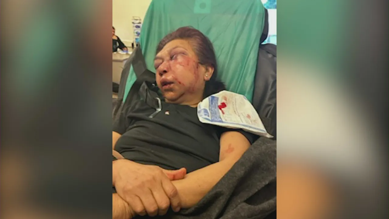 Featured image for "Violent Assault Shakes East LA Community: Elderly Woman Attacked at Home"