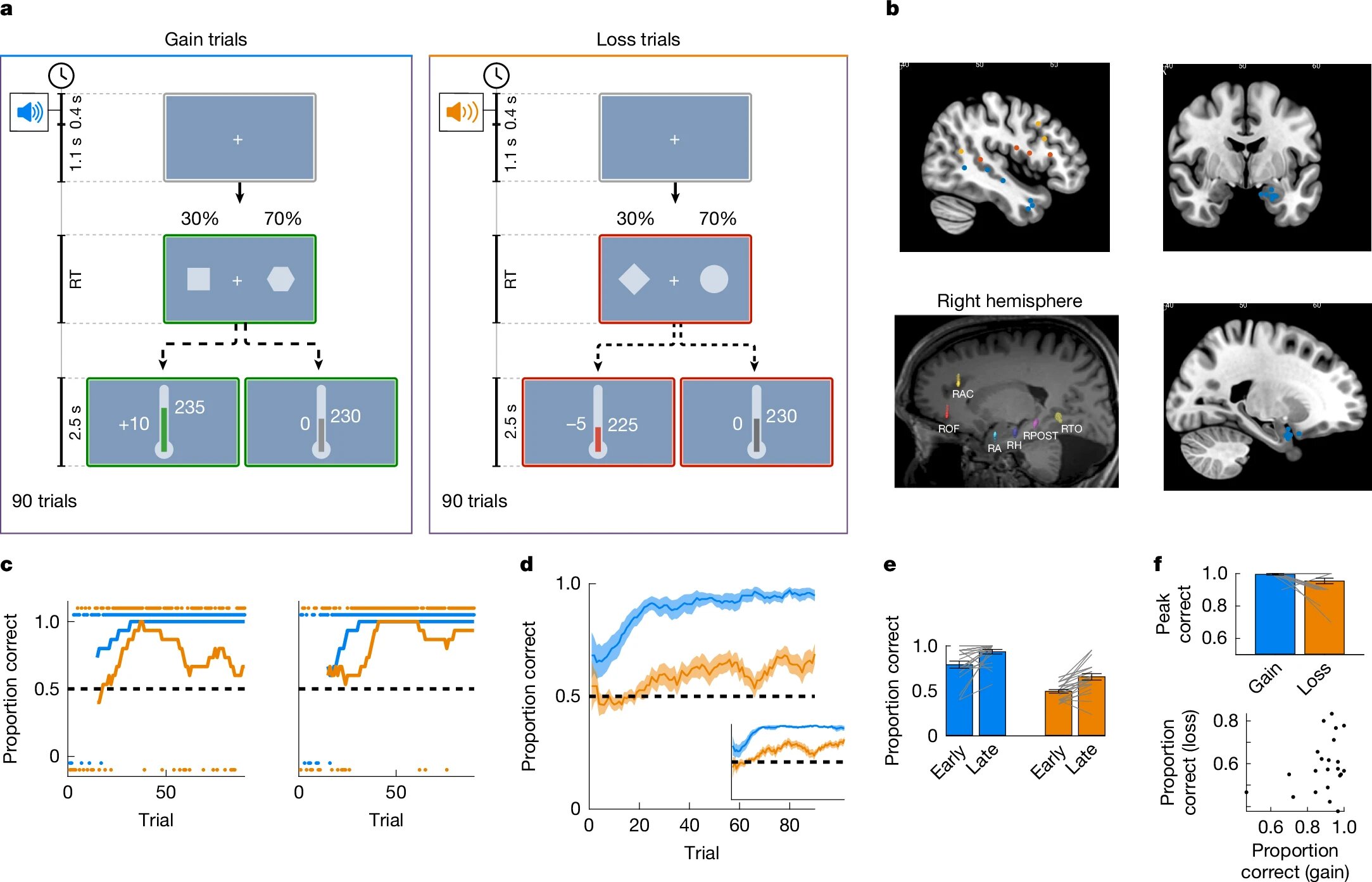Featured image for Humans prioritize avoiding losses over seeking gains in brain activity