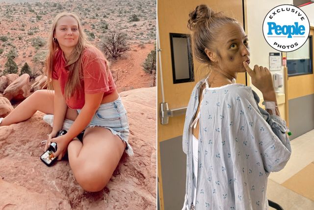 Featured image for Teen's Yellow Skin Leads to Urgent Liver Transplant Need