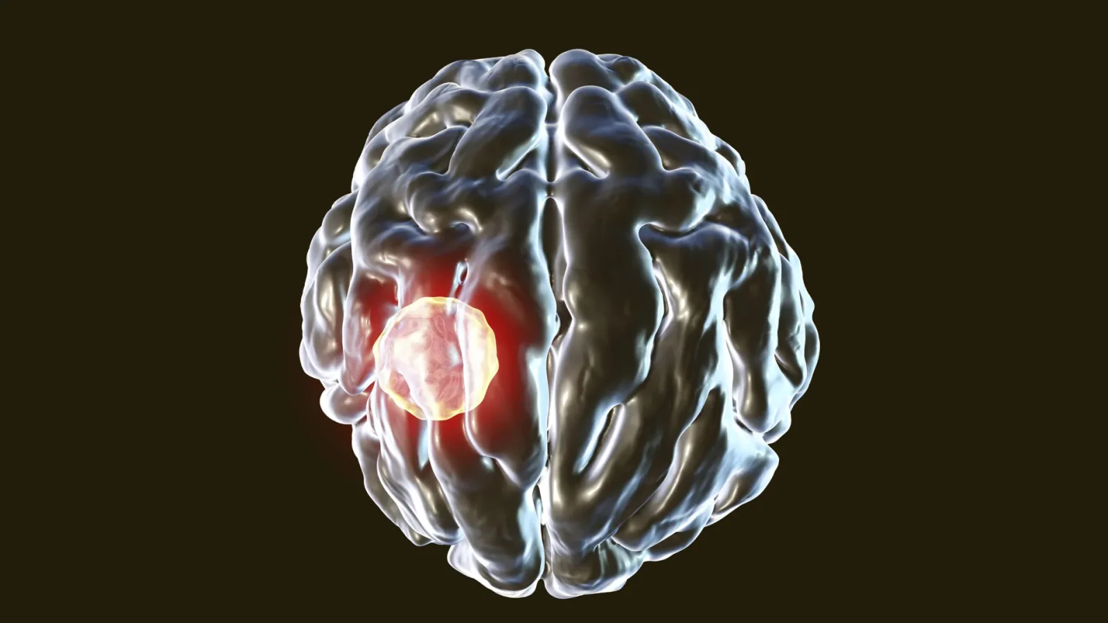 Brain Parasite Toxoplasma gondii Is Stopped by Immune Cells' Self-Destruct Switch