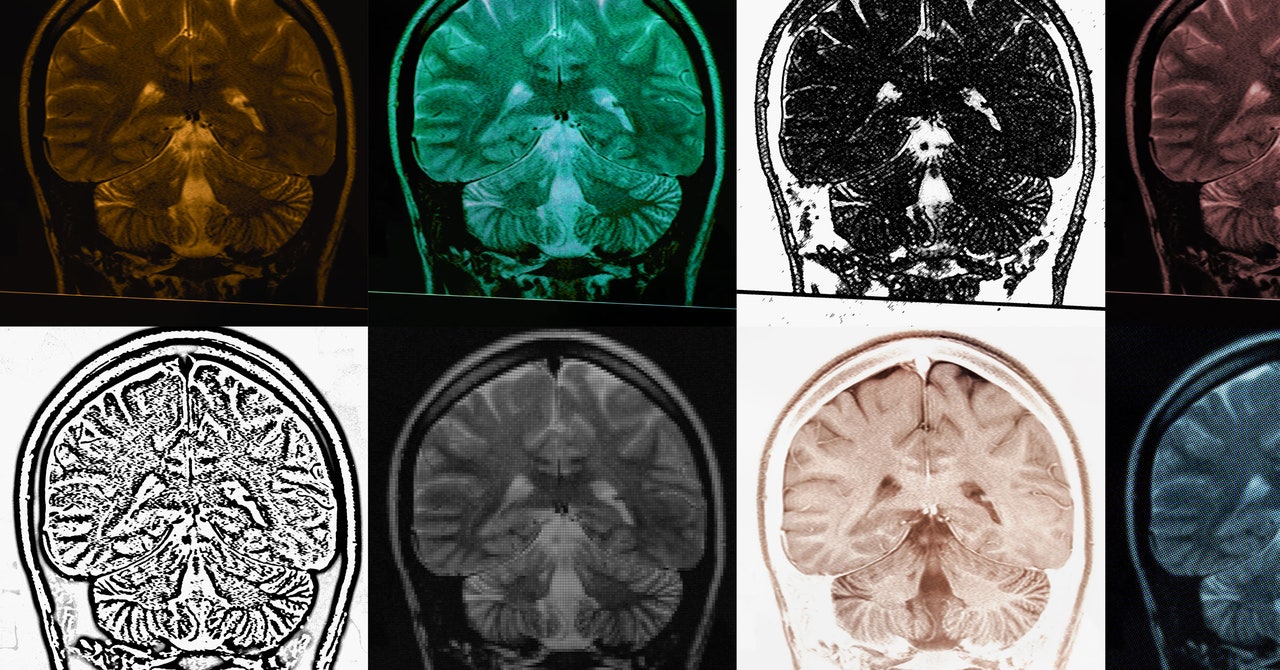 Featured image for The Science Behind the Delayed Effects of Antidepressants