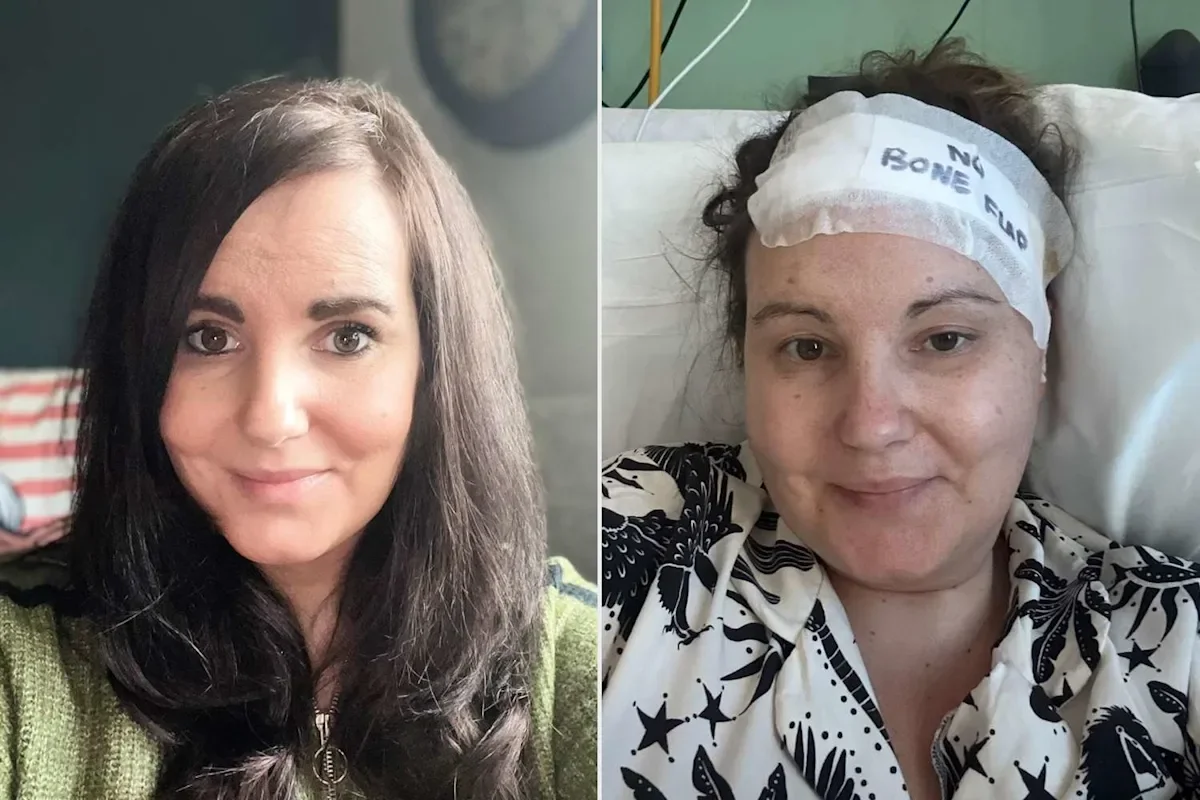 Welsh mom uncovers brain tumor after years of doctors attributing headaches to postpartum anxiety