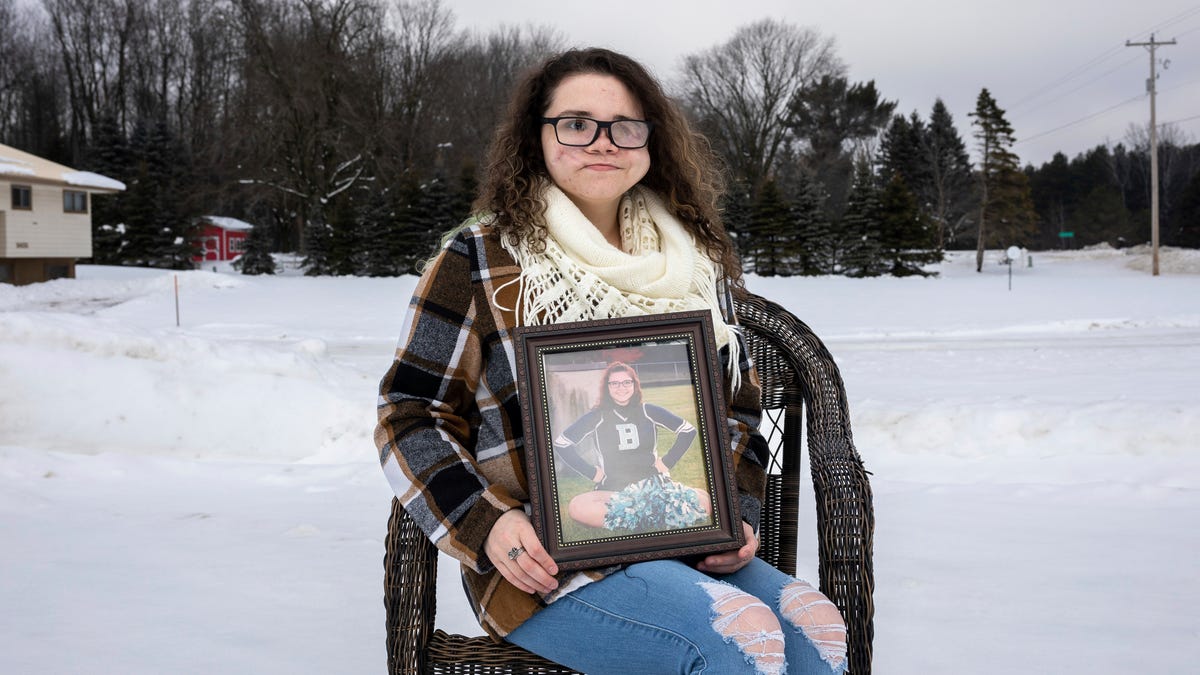 Michigan Woman Receives New Nose Years After Stepdad's Shooting