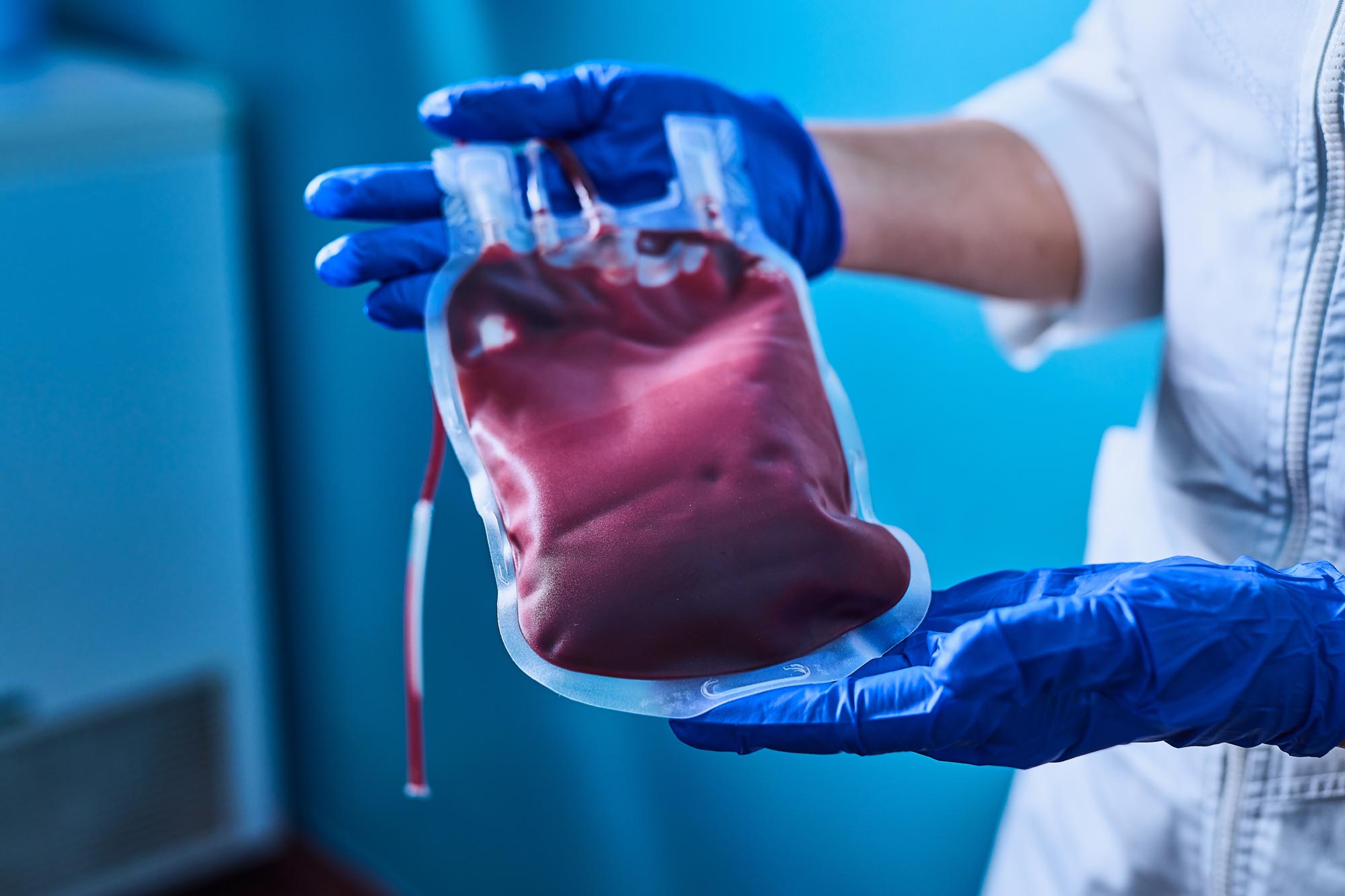 Featured image for Blood's Dual Role in Alzheimer's: Protection and Progression