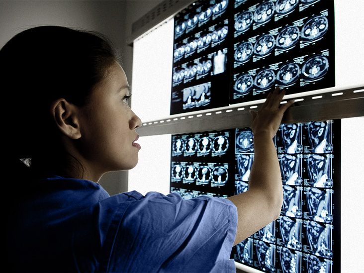 Featured image for "Link Between Medical Procedure and Transmitted Alzheimer's Cases Revealed"