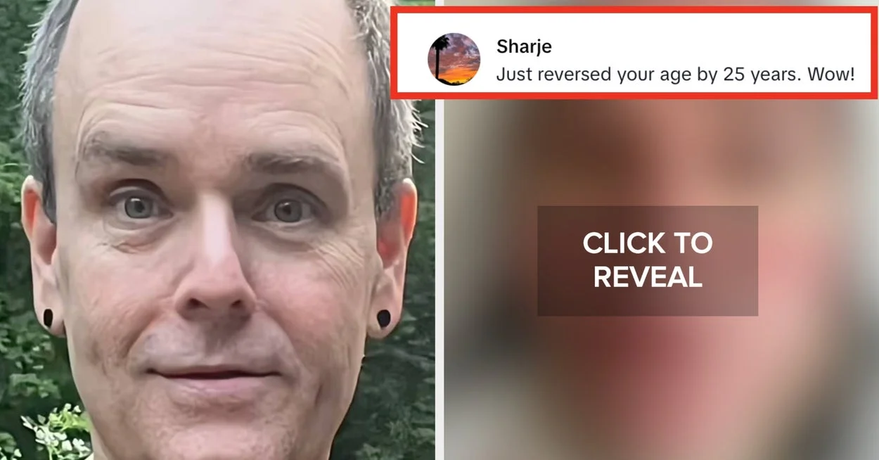 Man's Mexico Facelift Stuns onlookers