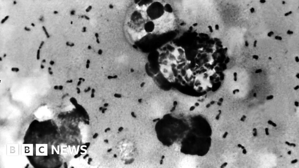 Featured image for Arizona Resident Dies from Plague, Health Officials Address Concerns