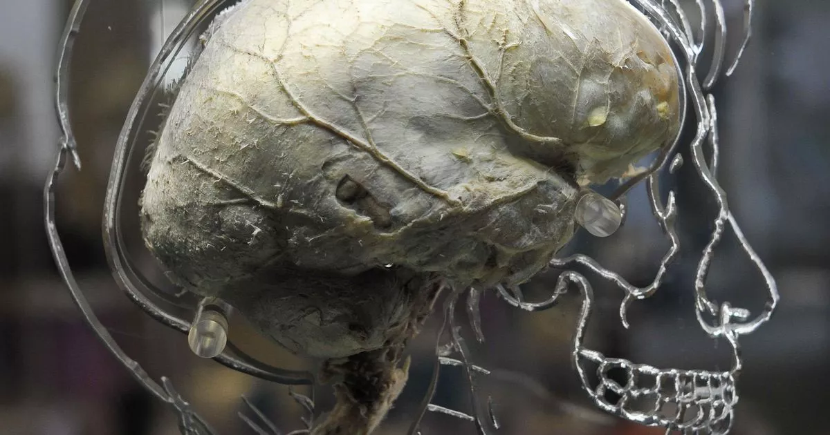 Featured image for "Midlife Spatial Navigation Issues Could Predict Alzheimer's Decades in Advance"