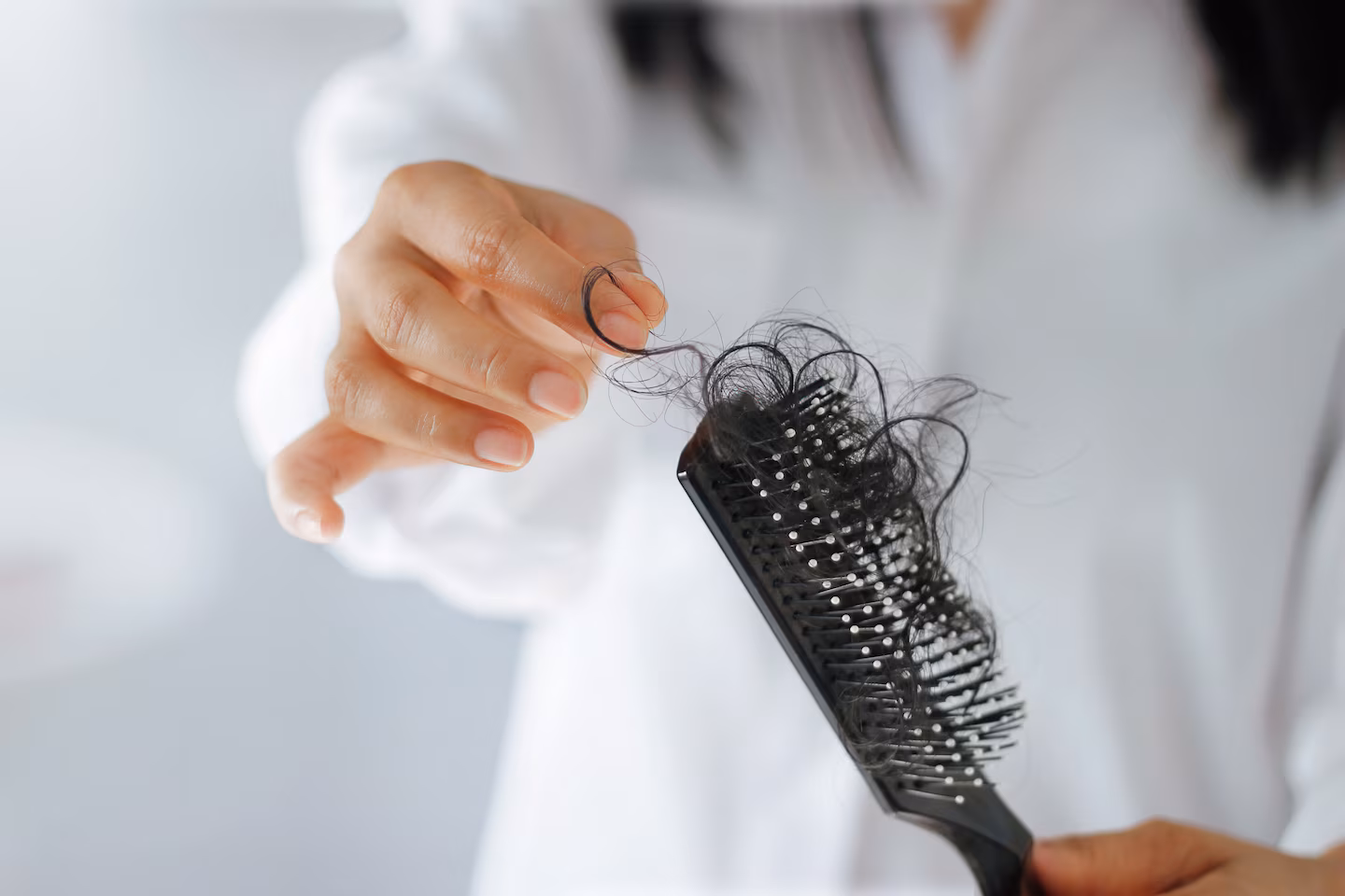 Featured image for Top Causes and Effective Treatments for Hair Loss