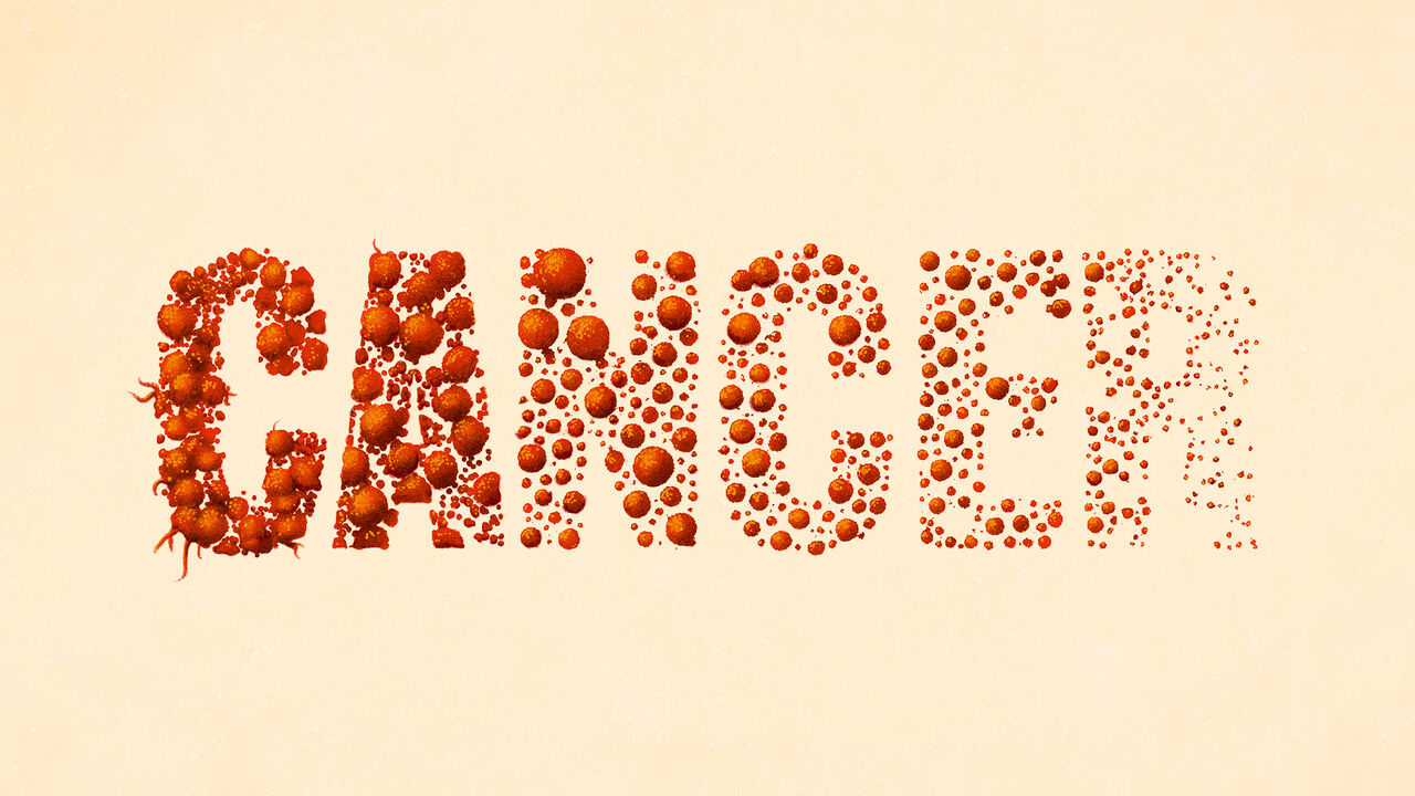 Featured image for Major Advances Signal a New Era in Cancer Treatment and Survival