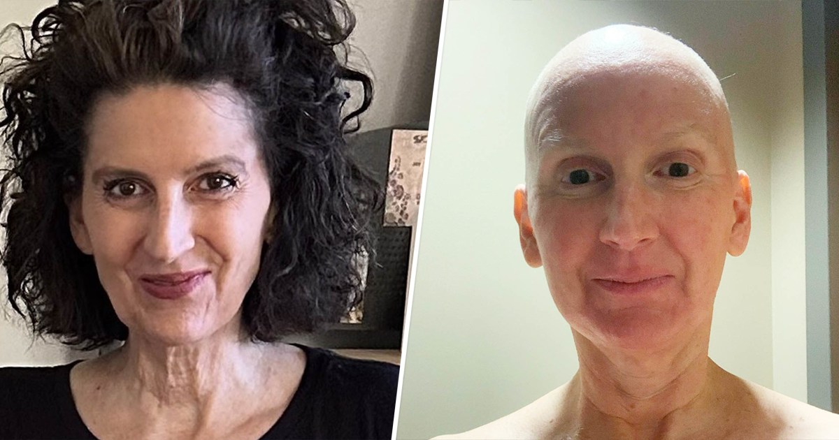 Featured image for "Leg Pain Leads to Shocking Leukemia Diagnosis"