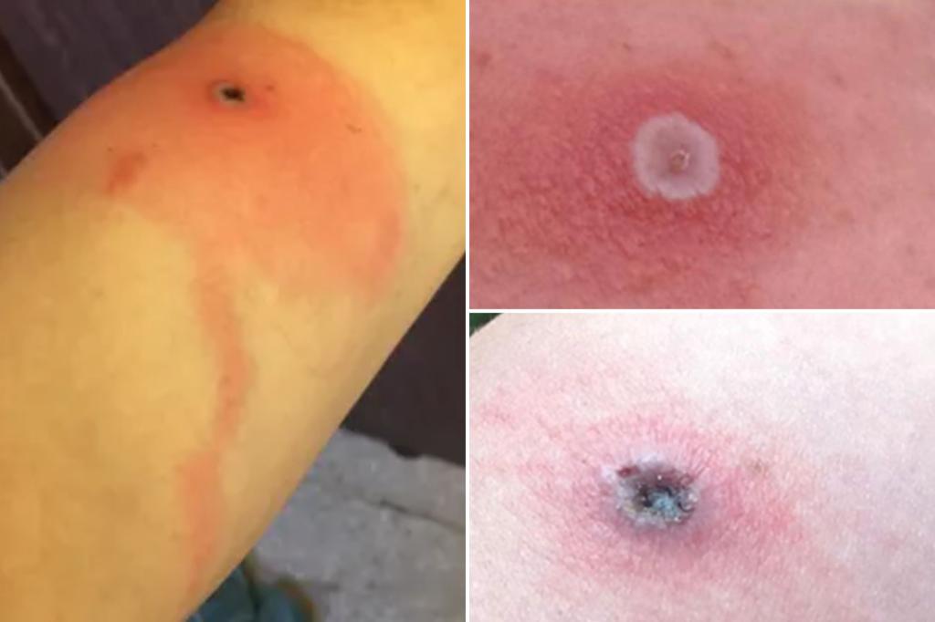 Featured image for "First Fatal Case of Alaskapox Confirmed in Elderly Man on Kenai Peninsula"