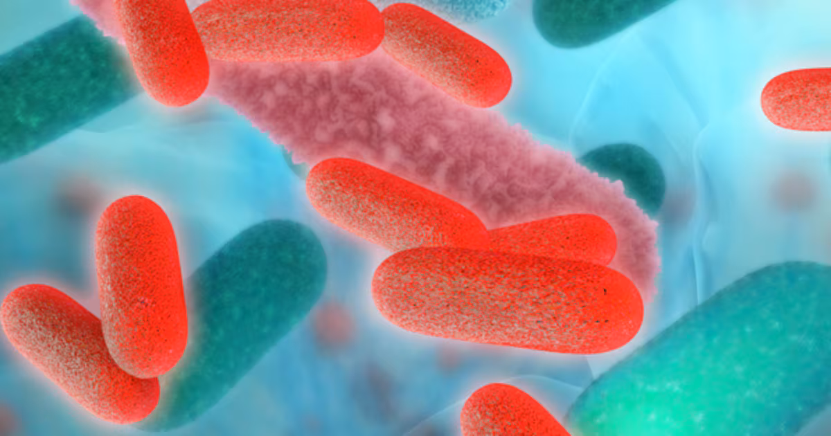Featured image for Legionnaires’ Disease Outbreak Linked to Ocoee Gym in Central Florida