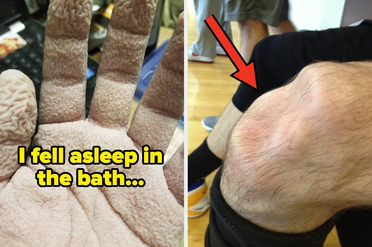 48 Photos Revealing the Power of the Human Body and Modern Medicine