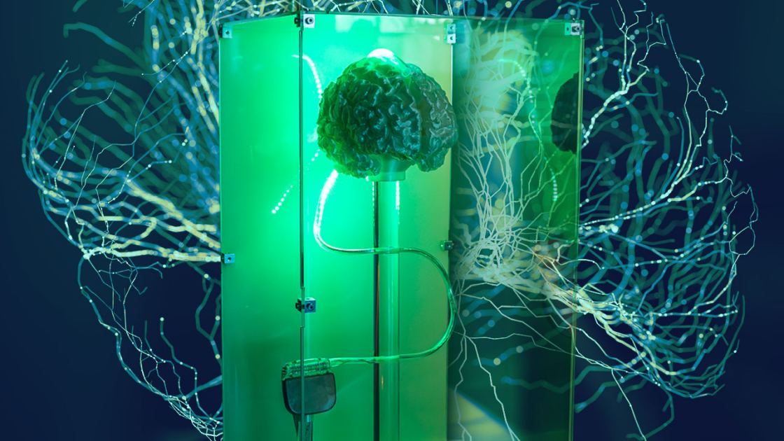 Featured image for Inside a Secret Brain Implant Firm: A Peek into Our Cyborg Future