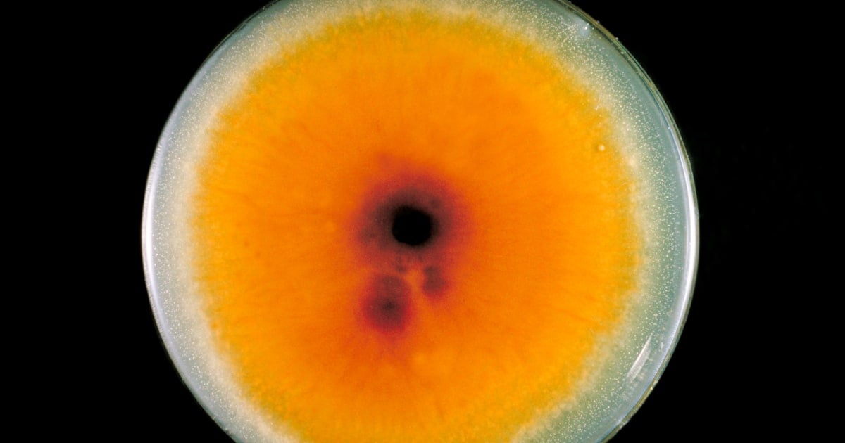 Featured image for "Sexually Transmitted Drug-Resistant Ringworm Detected in U.S."