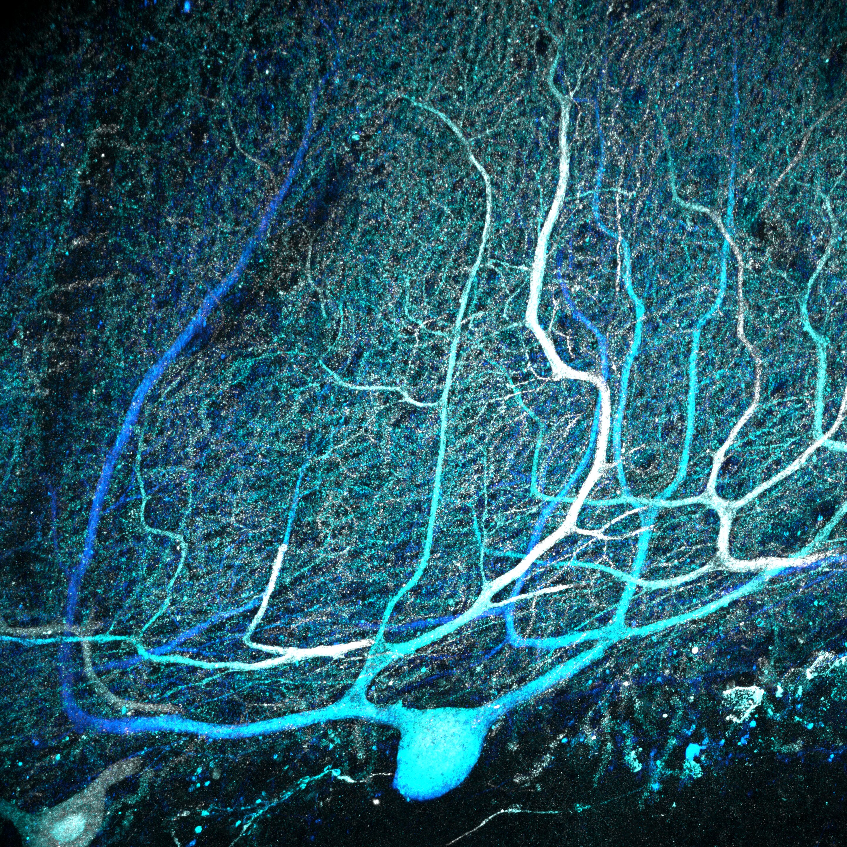Featured image for Surprising Discoveries: Extensive Brain Cell Connections Found in Cerebellum