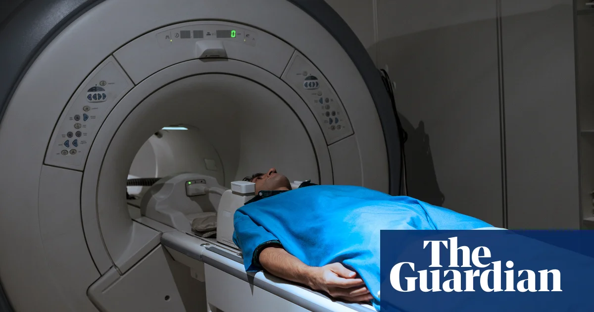 Featured image for Unaware Millions Suffer from Aggressive Fatty Liver Disease, New Guidelines and Insights Highlighted