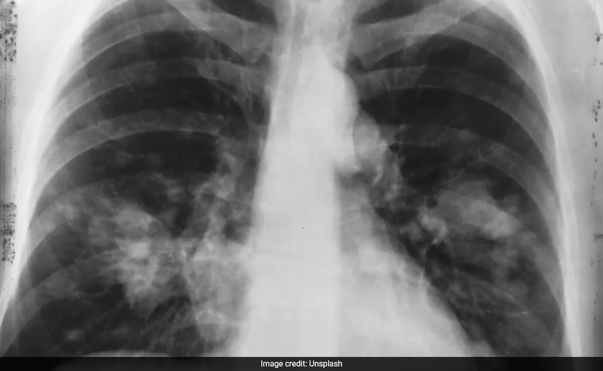 Featured image for "Promising New Drug Offers Hope for Mesothelioma Treatment Breakthrough"