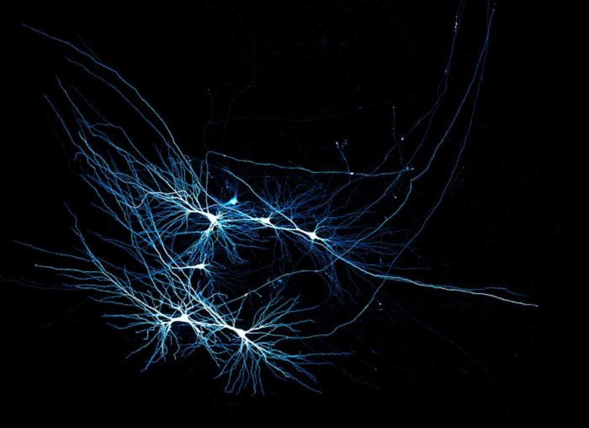 Featured image for Scientists Decode Unique Neural Wiring Behind Human Memory
