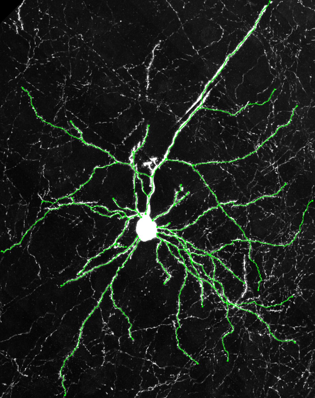 Featured image for CLOCK gene boosts brain connectivity and flexibility in mice