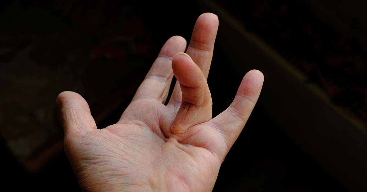 Featured image for Neanderthal Ancestry Linked to "Viking Disease" Hand Condition