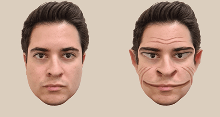 Featured image for Man Living with Rare Neurological Condition Sees Distorted 'Demon-Like' Faces