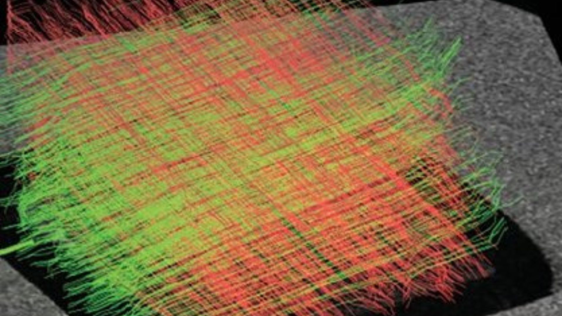 "Researchers 3D Print World's First High-Resolution Brain Phantom"