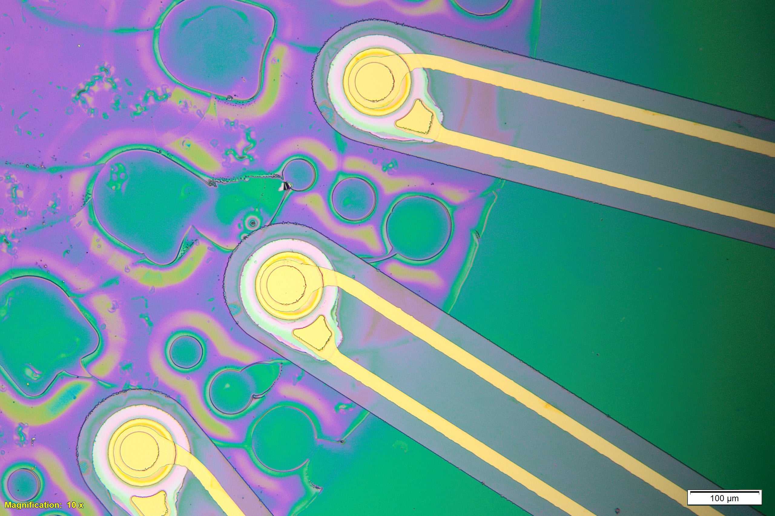 Featured image for "Ultrasound Revolutionizes Deep Brain Stimulation"