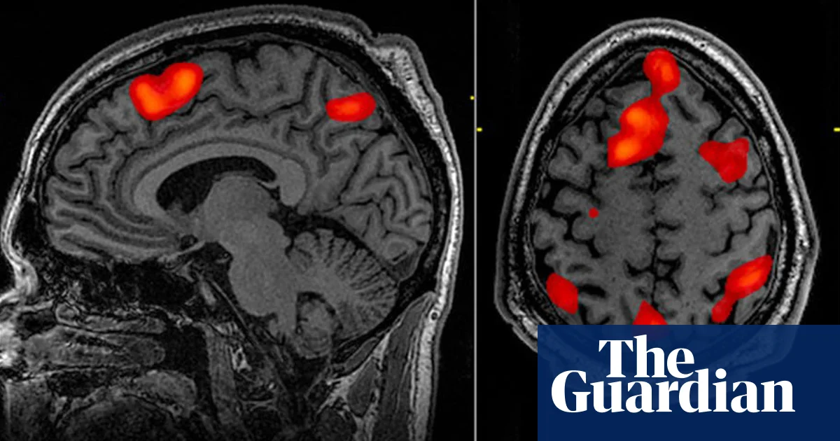 Advancements in AI allow for non-invasive mind-reading through text conversion.