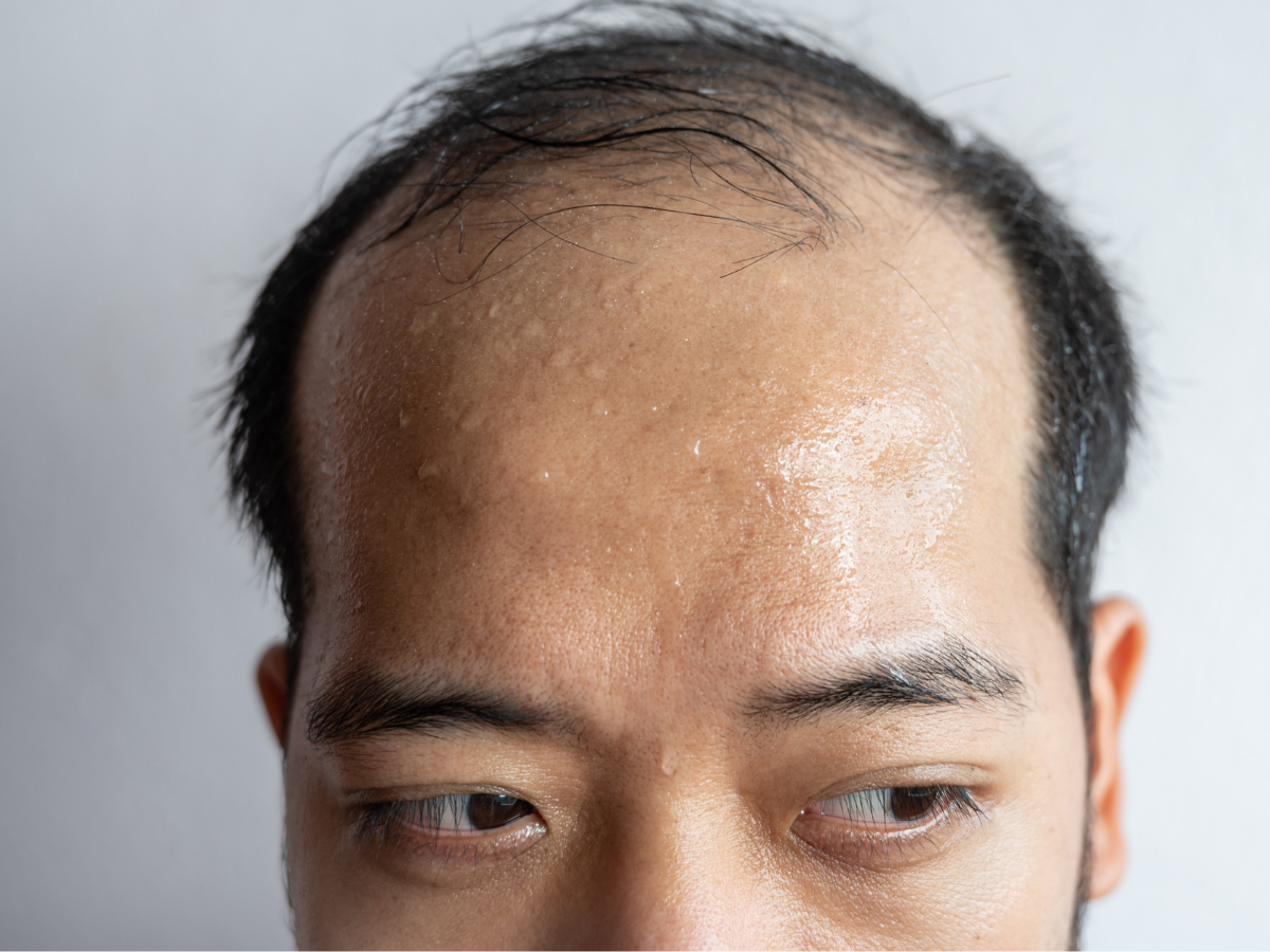 Featured image for "Spotting Vitamin D Deficiency: 5 Skin Signs to Watch for"