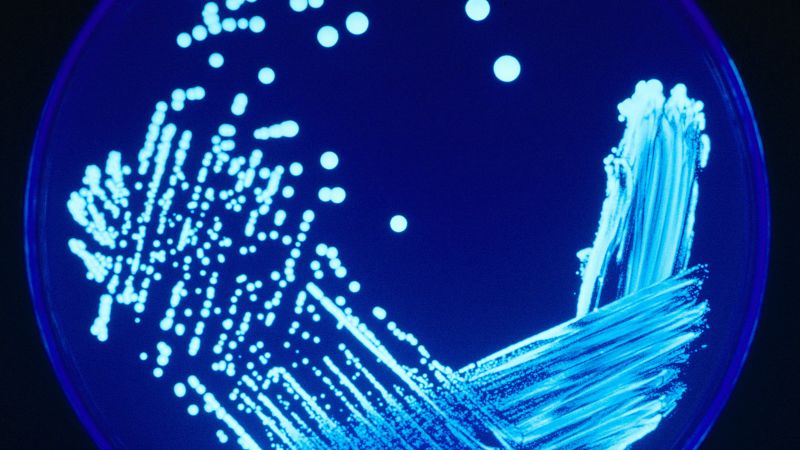 Featured image for Transplanted Lungs Transmit Deadly Legionella Infection to Two Recipients