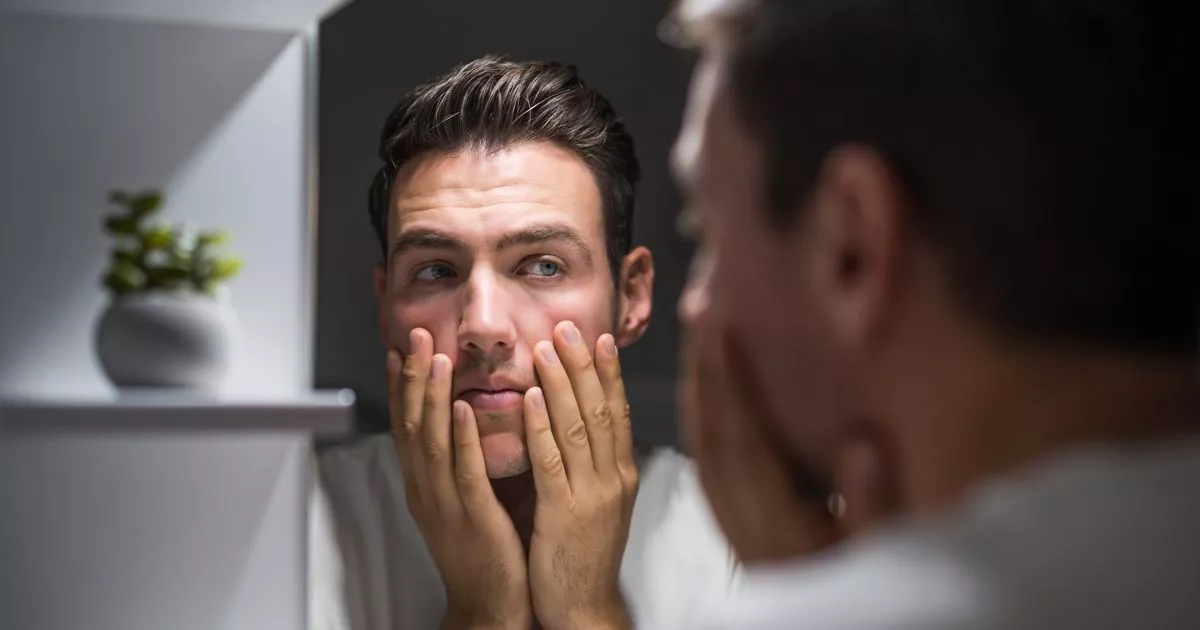 Overlooked Signs of High Cholesterol on Face, Hands, and Feet