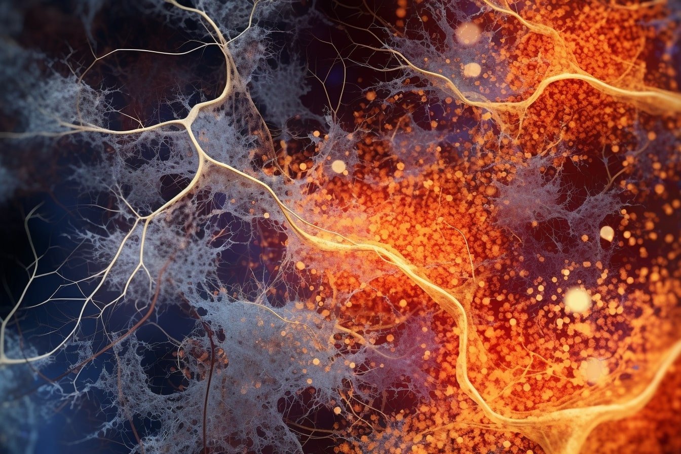 Early Multiple Sclerosis Detected by Loosely Wrapped Myelin.