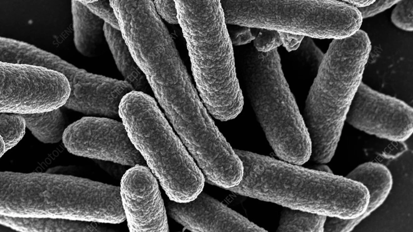 Featured image for E. coli Outbreak at Bellevue Teriyaki Restaurant Sickens Six