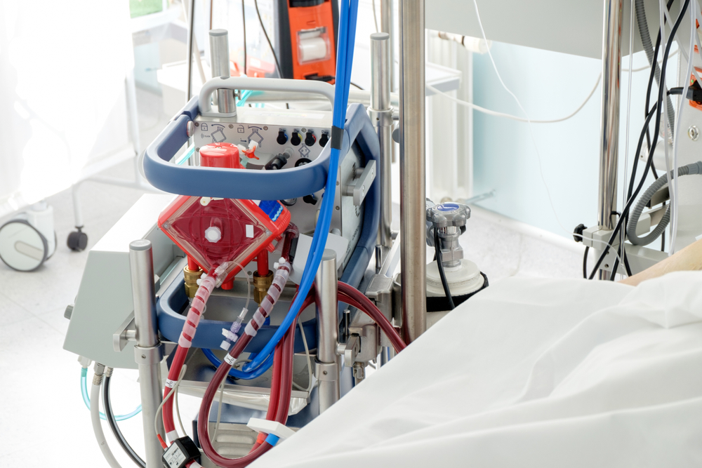 Featured image for ECMO: A Promising Treatment for Critically Ill Obese Patients