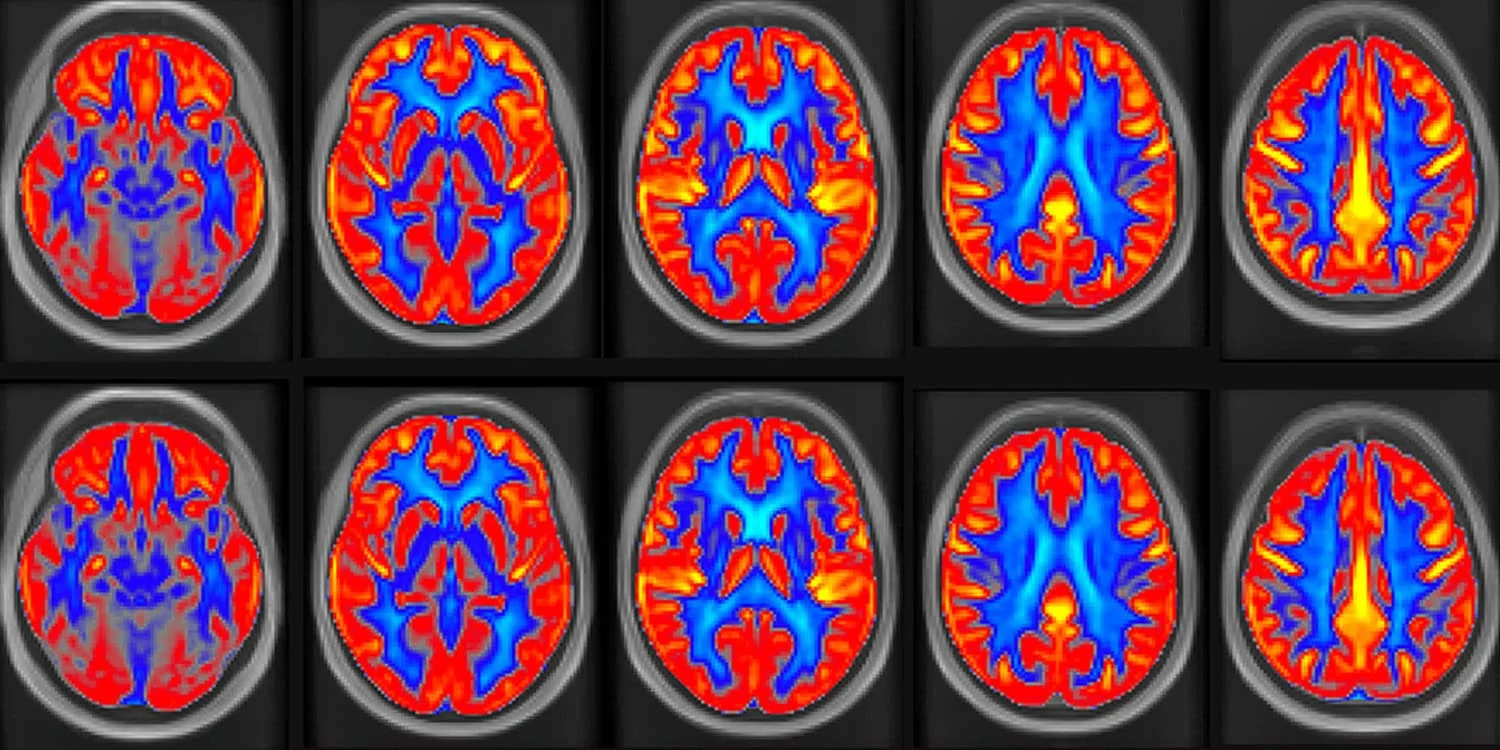Featured image for Snack Boosts Memory and Brain Health in 16-Week Study