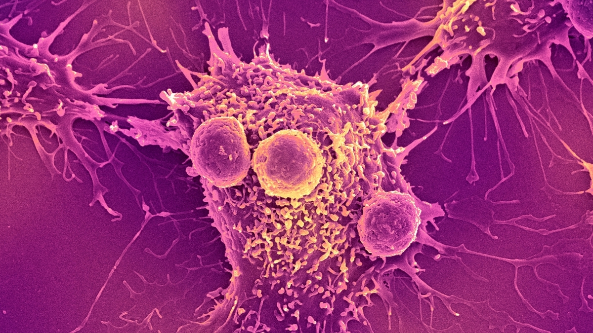 Featured image for Innovative Cancer Vaccine Shows Promising Long-Term Prevention in Mice