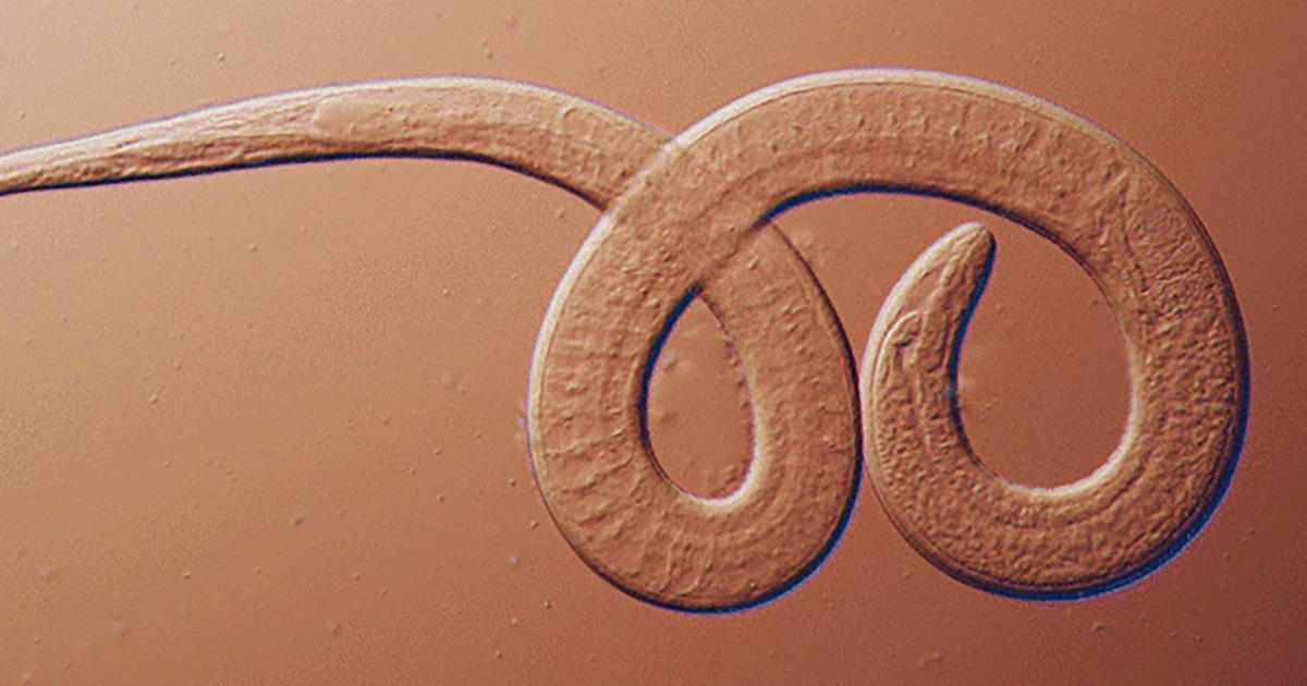 Featured image for Family Contracts Brain Worms from Undercooked Bear Meat