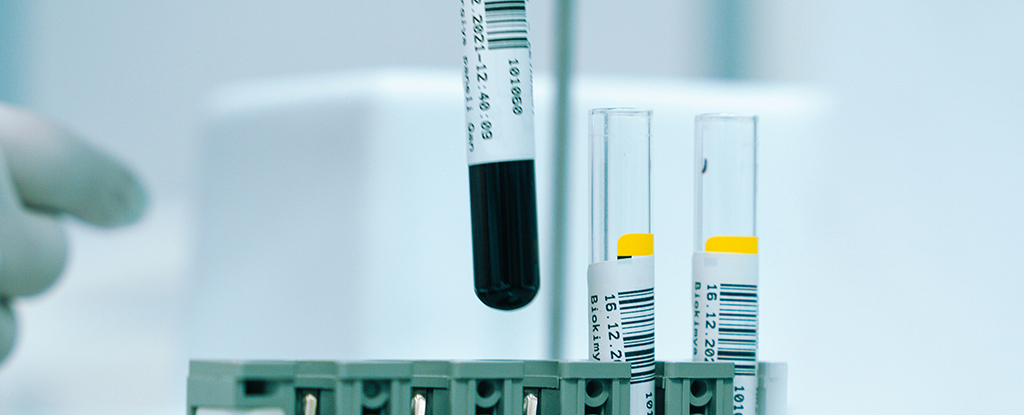 Innovative Blood Test Detects Cancer Up to Three Years Early