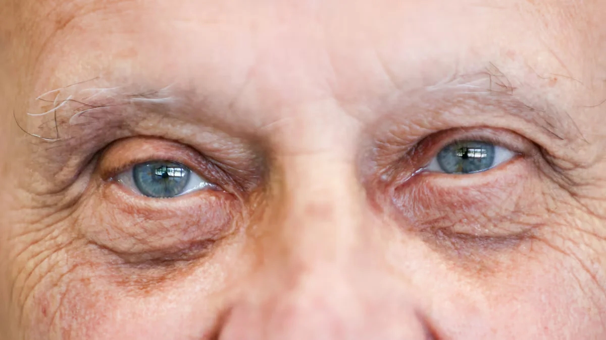 "Florida's Eye Degeneration Epidemic: New Drugs Offer Hope for Vision Preservation"