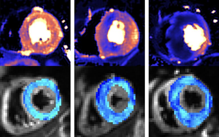 Featured image for Early Detection: Revolutionary Scanning Methods Uncover Silent Killer