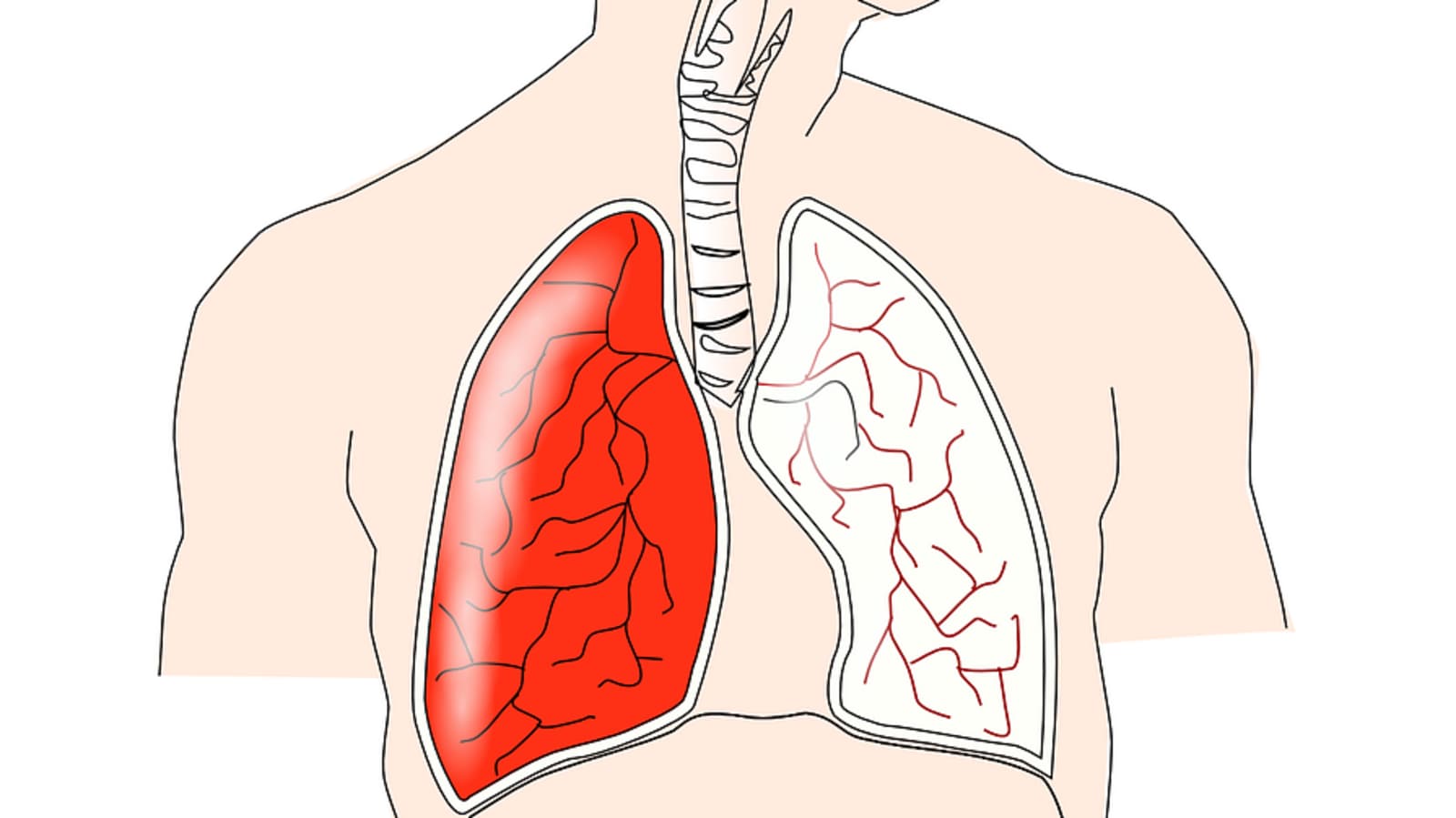Featured image for Phlegm Color as a Prognostic Indicator for Lung Disease: Study